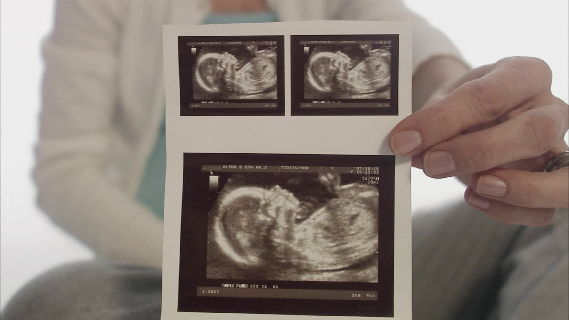 358420617 / Abdomen / Pregnancy / Sweden