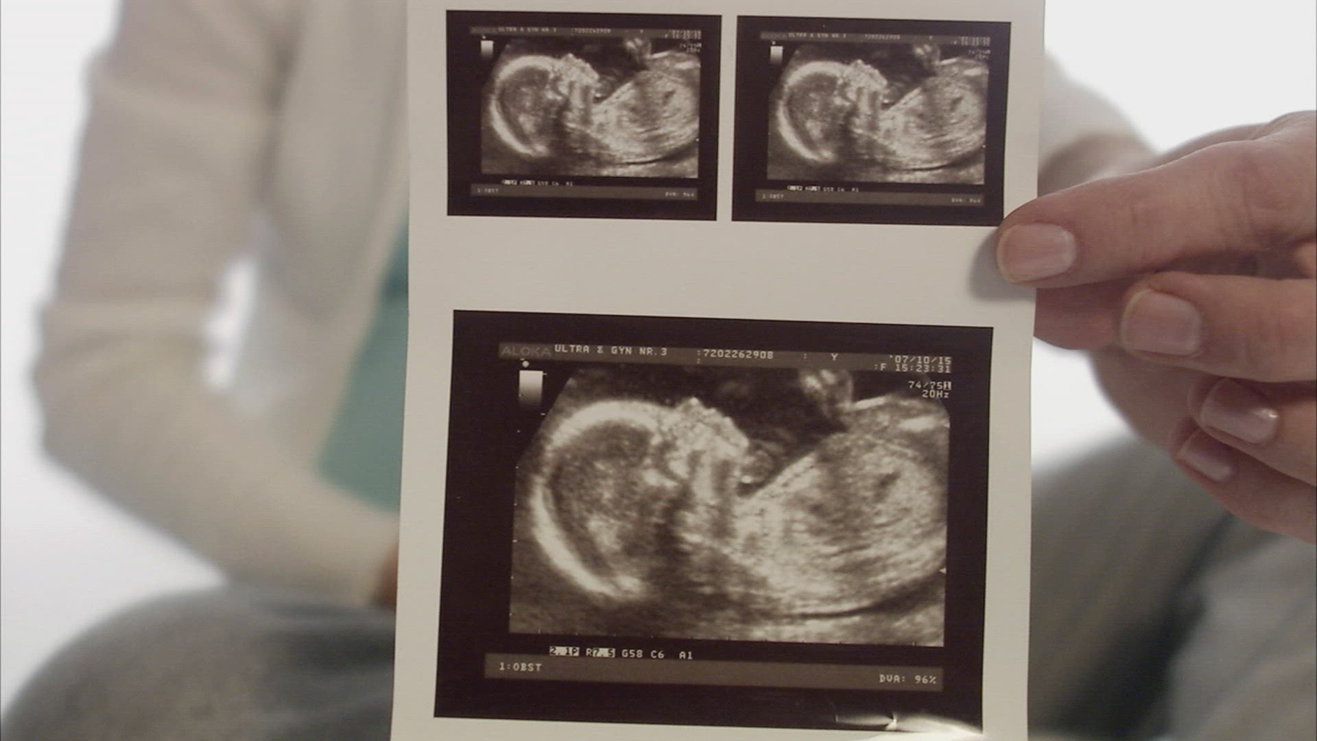 757524571 / Abdomen / Pregnancy / Sweden