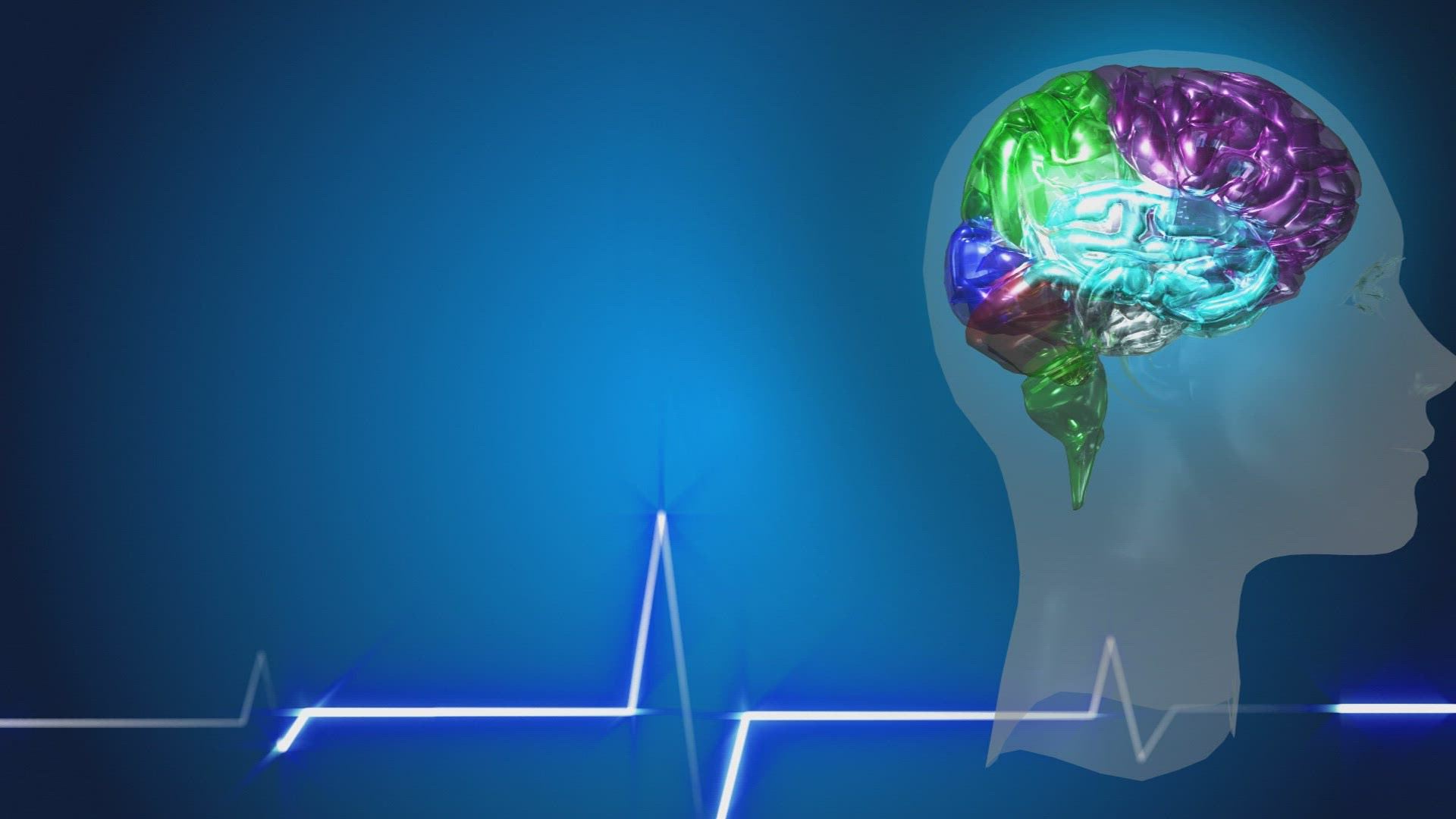 506216852 / Brain / Computer Animation