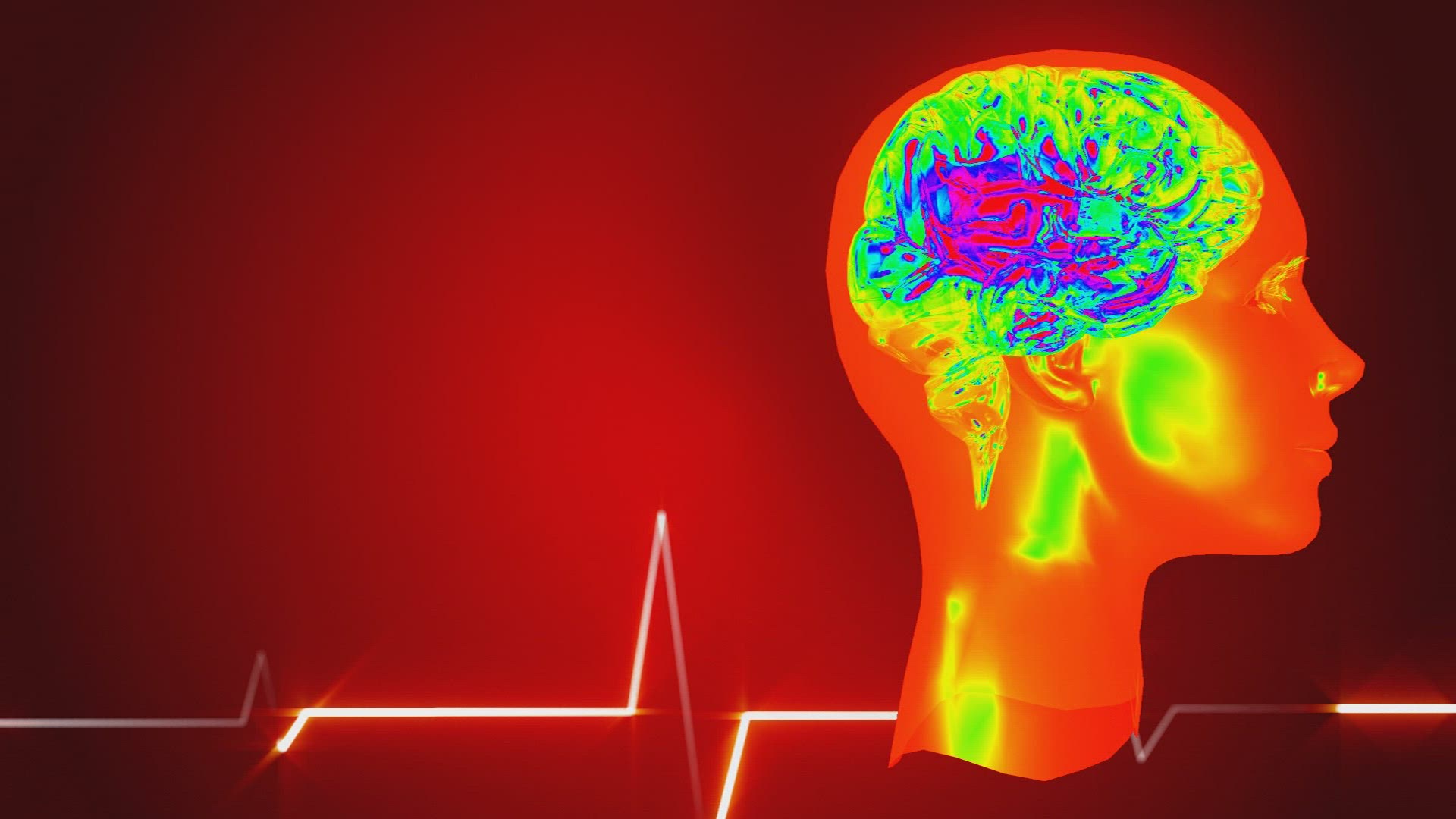 519292706 / Brain / Computer Animation