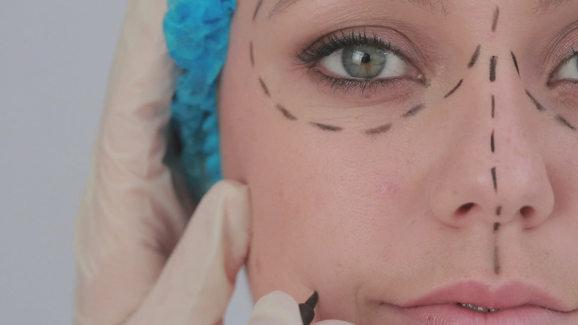 668668317 / Woman / Cosmetic Surgery