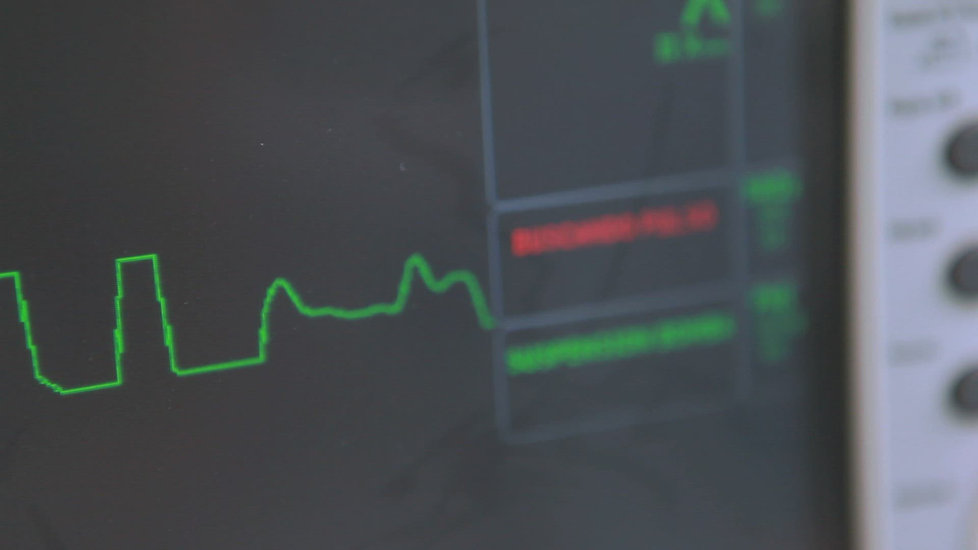 230061547 / Heartbeat / Measuring