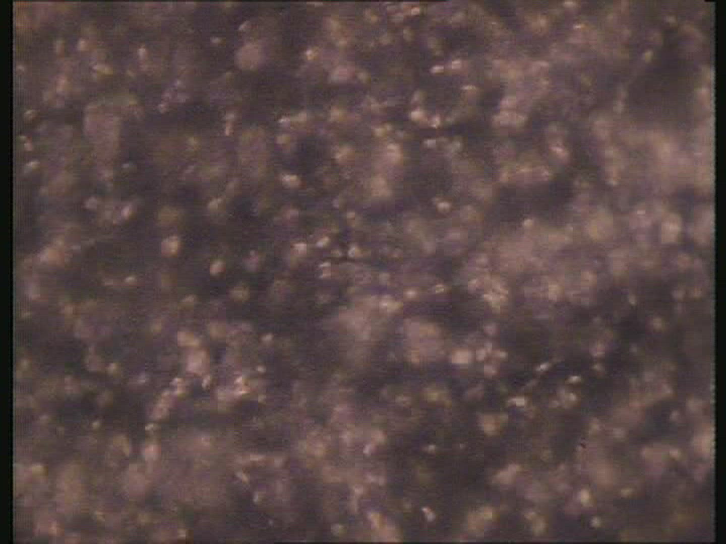 Sperm forming in the testicles. 