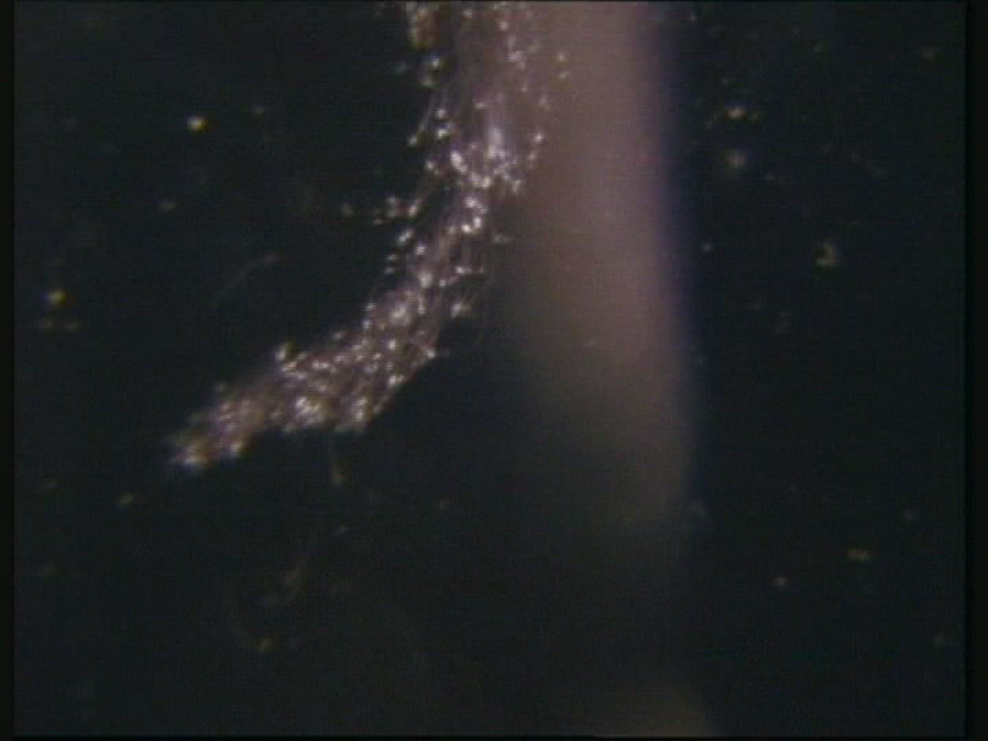 sperm swimming