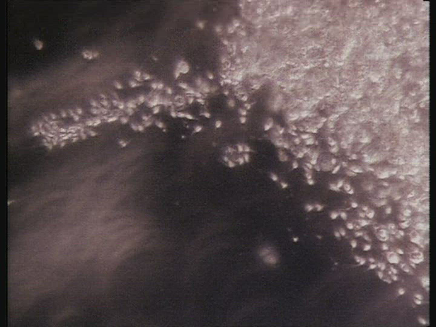 Sperm swimming towards egg