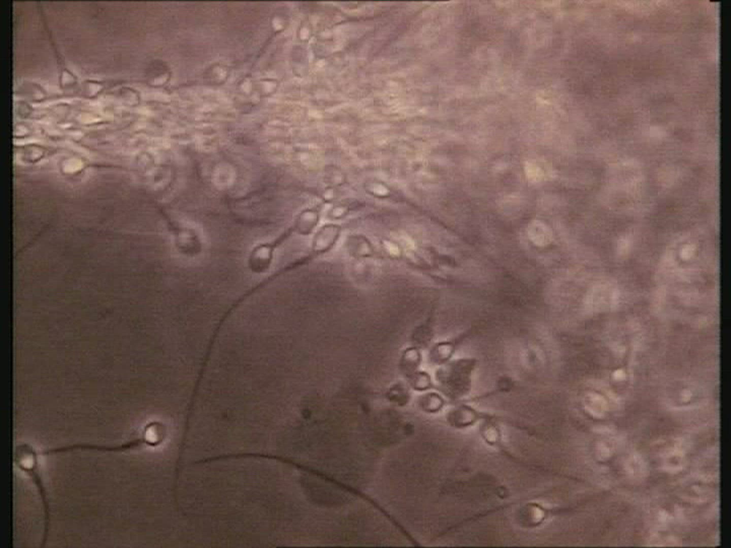 A cluster of human sperm swimming