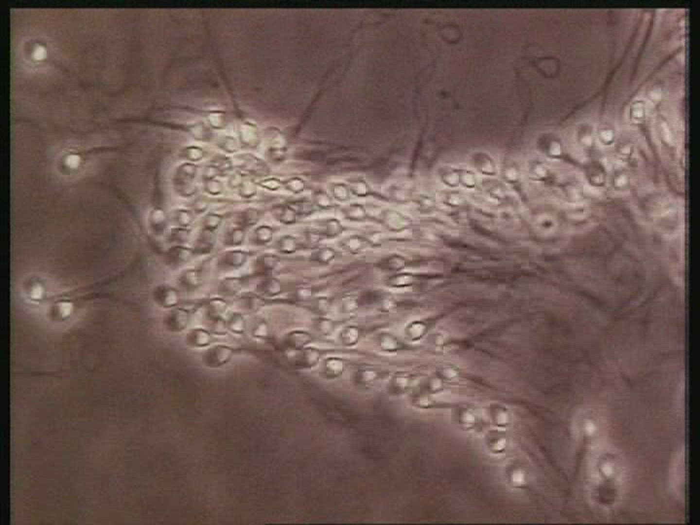 Sperm swimming in search of egg. Human sperm