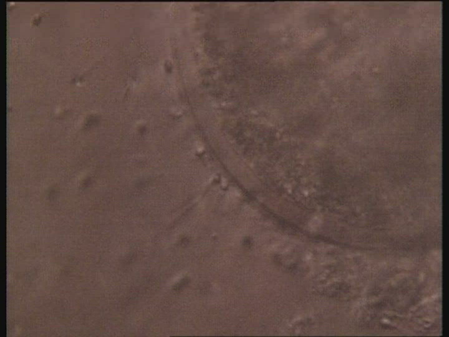 Sperm around human egg. Sperm attempting to penetrate protective layer around the egg