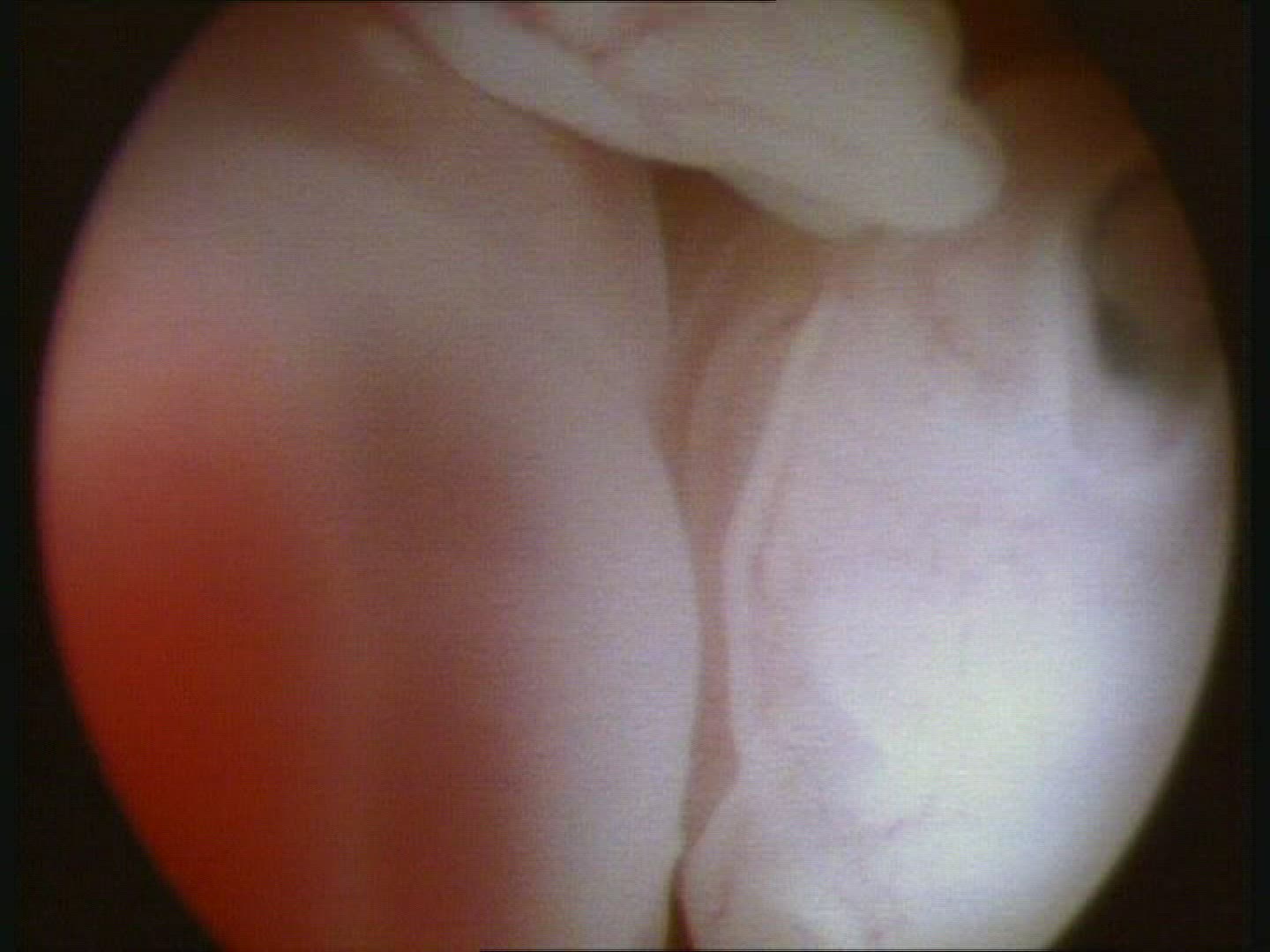 Foetus in womb 8 weeks. Heart beating, paddle-like limbs, face , eye, nose, uterus wall