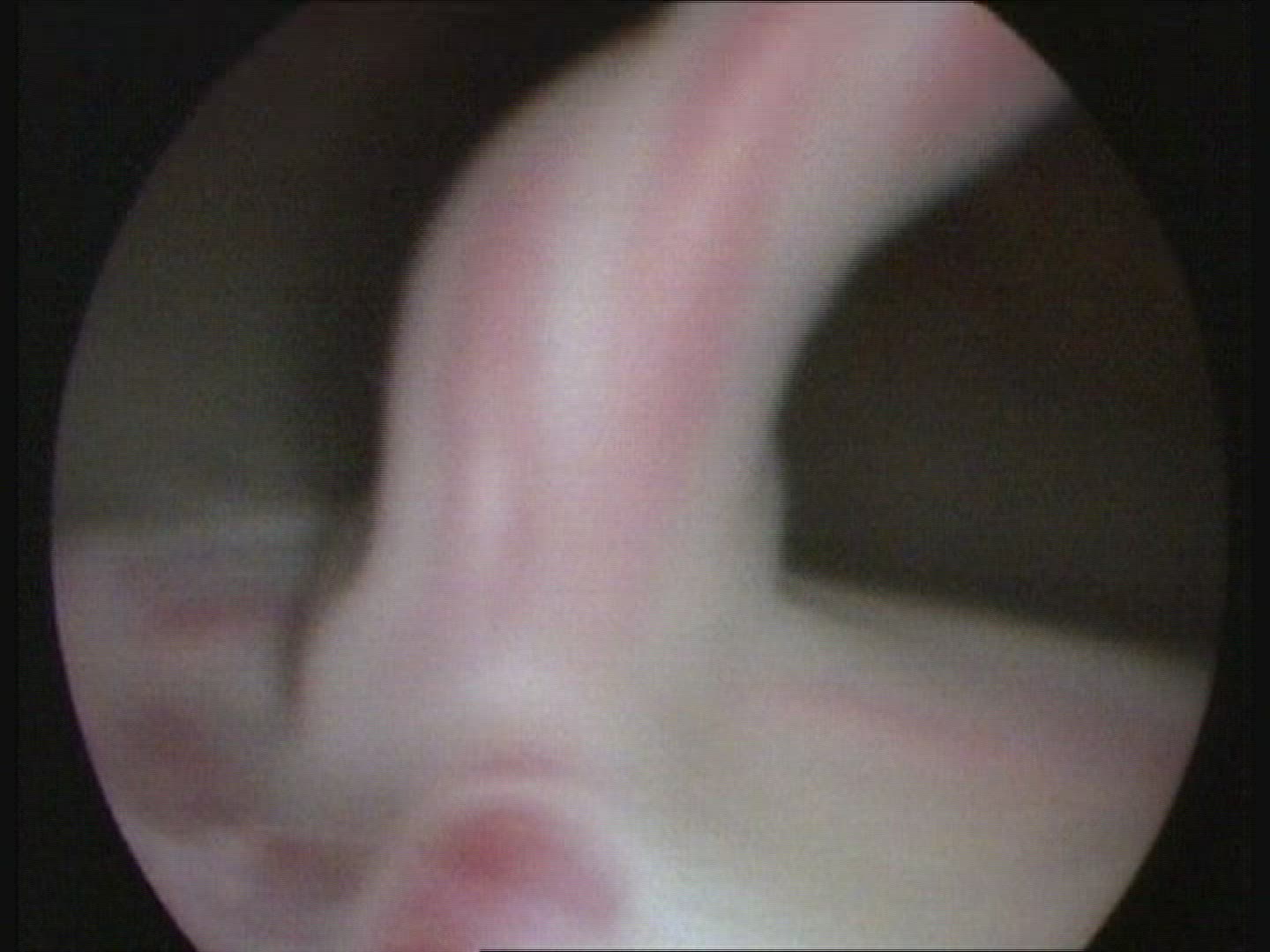 Foetus 18 weeks in womb, umbilical cord, face and hands. Baby moving