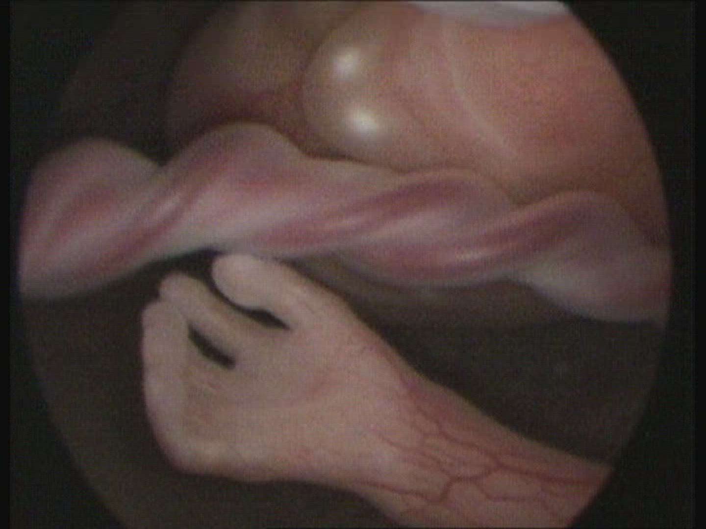 Foetus umbilical cord, face and hands moving