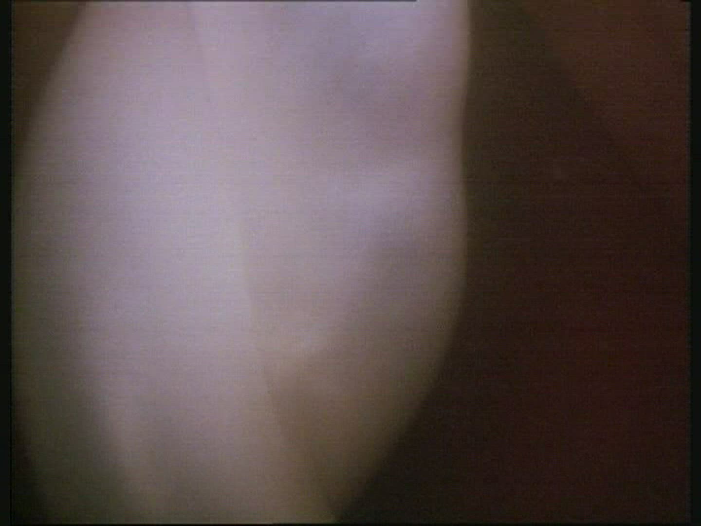 Human foetus umbilical cord pulsing