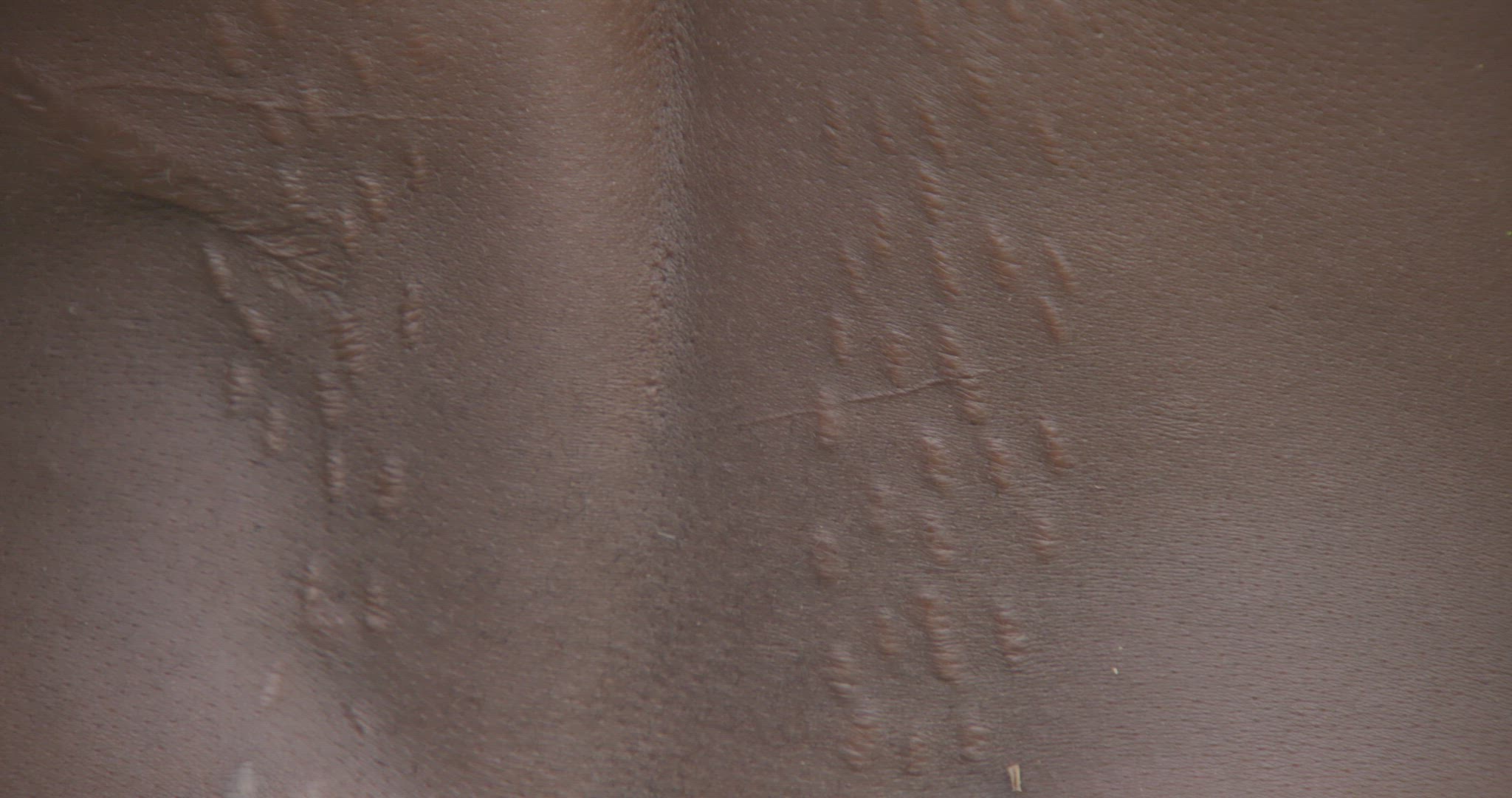 detailed scarification on back