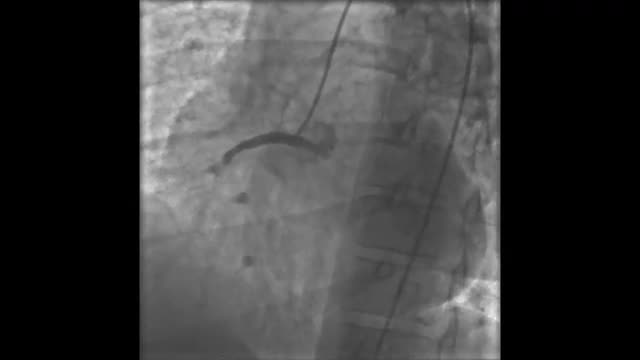 A collection of four actual scans of the human heart.