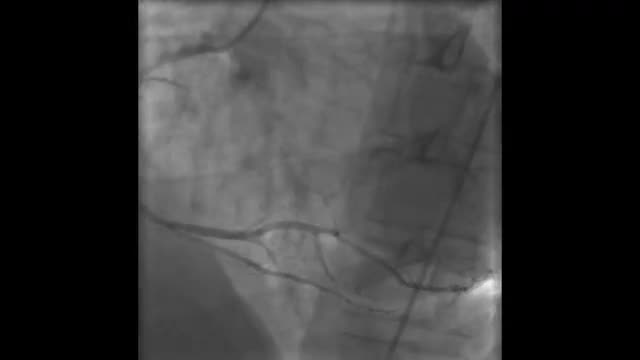 Cardiac Catheterization Scans 3731