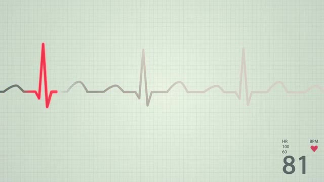 Heart rate diagram.