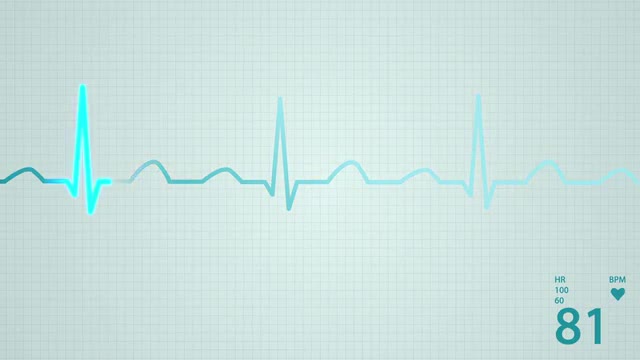 Heart rate diagram.