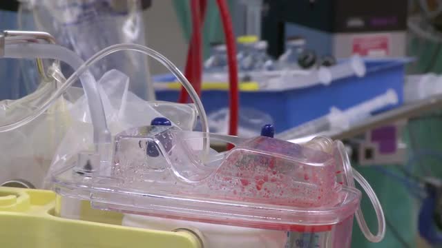 Tubes carry blood from a bypass machine (5 of 8)