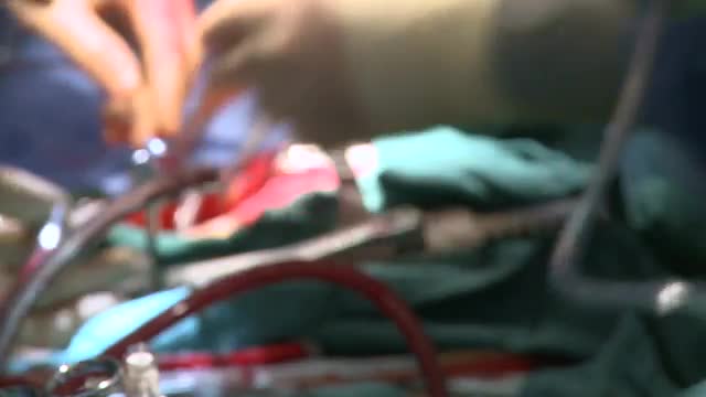 Depth of field of heart surgery (1 of 2)
