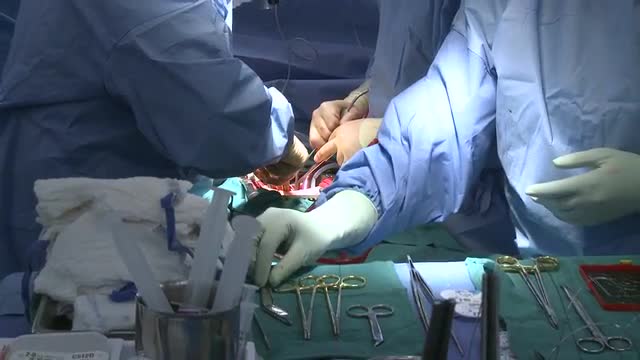 Zoom out open heart surgery (1 of 2)