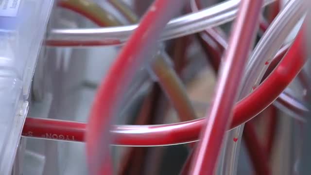 Blood running through heart bypass machine (2 of 4)