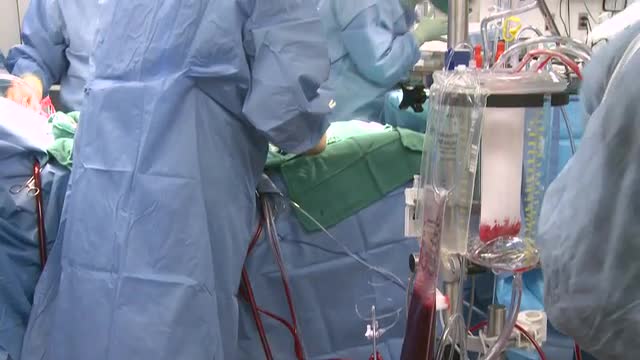 Surgery in progress using heart lung bypass machine
