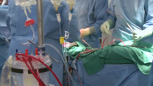 Surgical team monitors blood flowing through bypass tubing