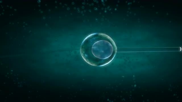 In Vitro Fertilization (IVF).