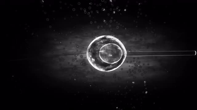 In Vitro Fertilization (IVF).