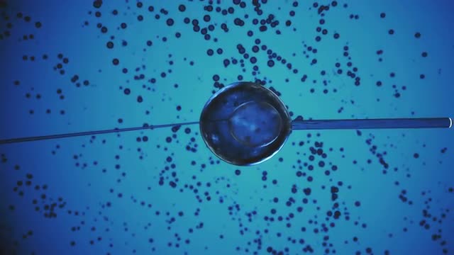 In Vitro Fertilization (IVF).