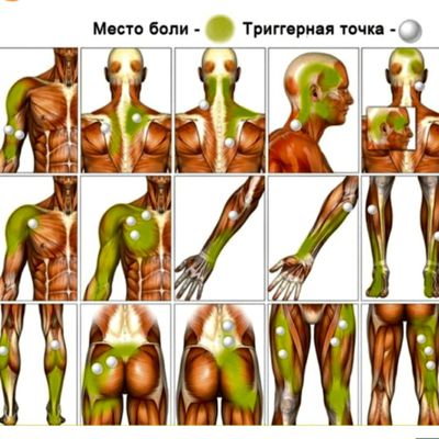 Trigger Points