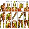 Trigger Points