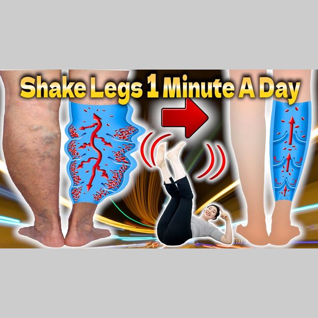 Shaking your Legs 1 minute a Day to Fix Venous Valve Takes 10 lbs off