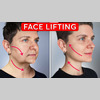 Reduce Wrinkles