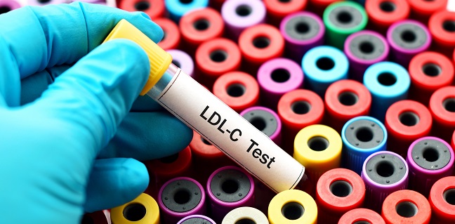 Hdl機能に関する研究 病態代謝部 各部のご紹介 国立循環器病研究センター 研究所