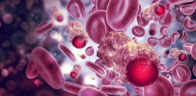 Ticonc Ticagrelor May Cut Tumor Induced Platelet Aggregation In Cancer Patients Tctmd Com