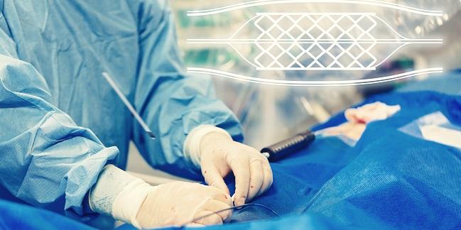 Polymer-Free Stent Noninferior to ZES at 3 Years: ReCre8
