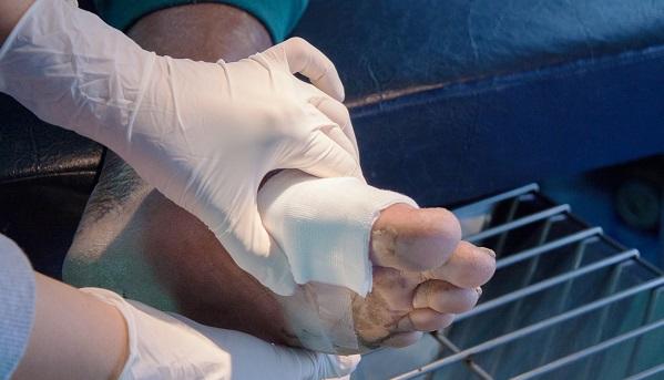 Critical Limb Ischemia During COVID: Lessons for Care and Clinical Trials