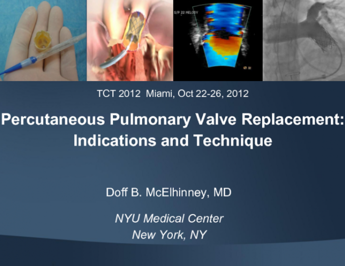 Percutaneous Pulmonary Valve Replacement Indications and Technique