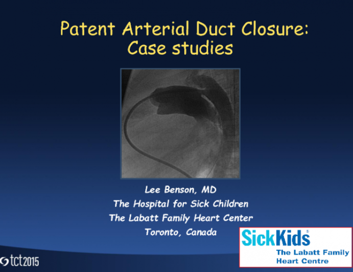 Two Illustrative Cases of PDA Closure One Simple and One Large and Complex
