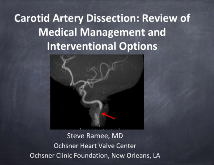 Carotid Artery Dissection Review of Medical Management and