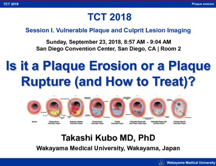 Case 2 Is it a Plaque Erosion or a Plaque Rupture (and How to Treat