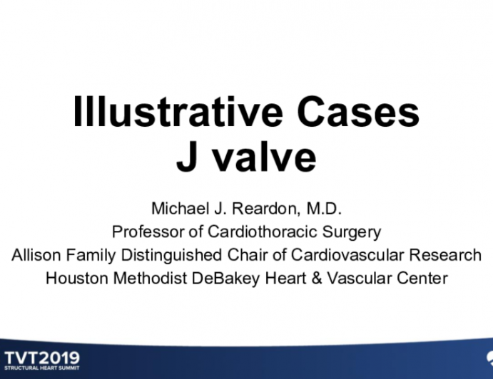 Types of case study with example picture