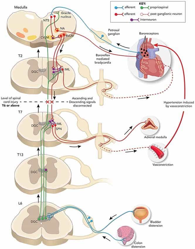 Anesthesia considerations in spinal cord injury patients: An