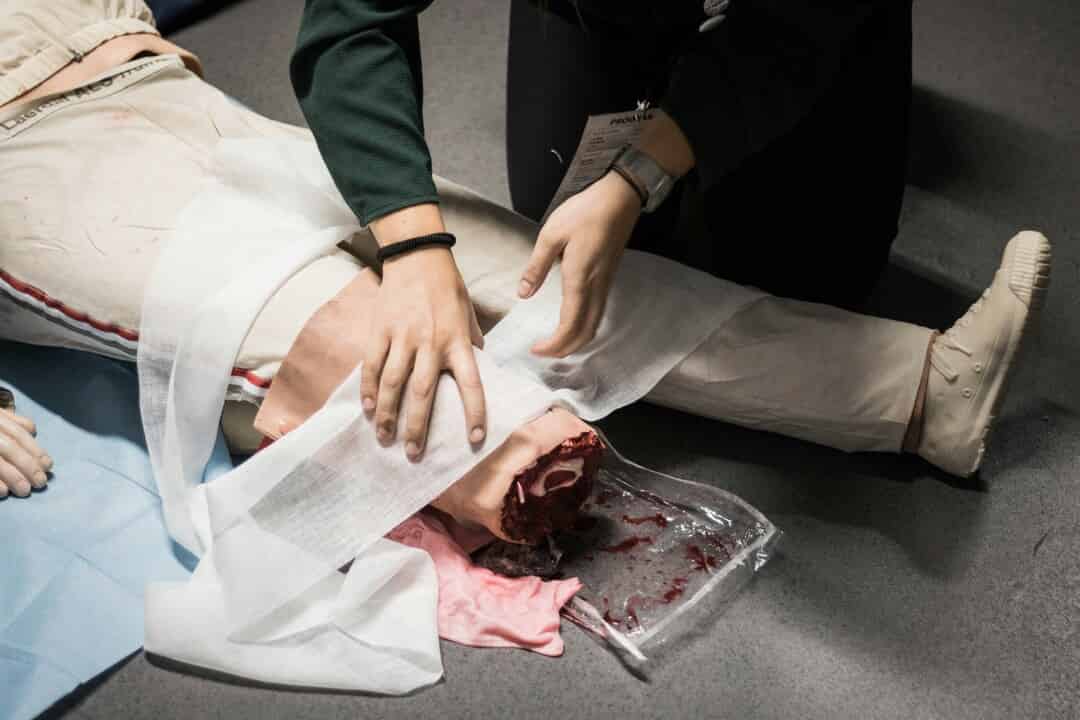 Limb Amputations at A Rural Tertiary Hospital: Evaluating Patient ...
