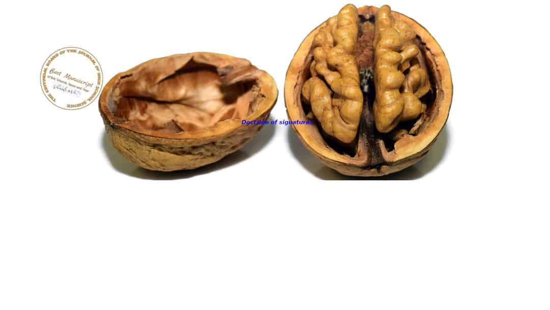 Walnut On Radiograph Automated classification and segmentation of Intracranial Hemorrhages ...