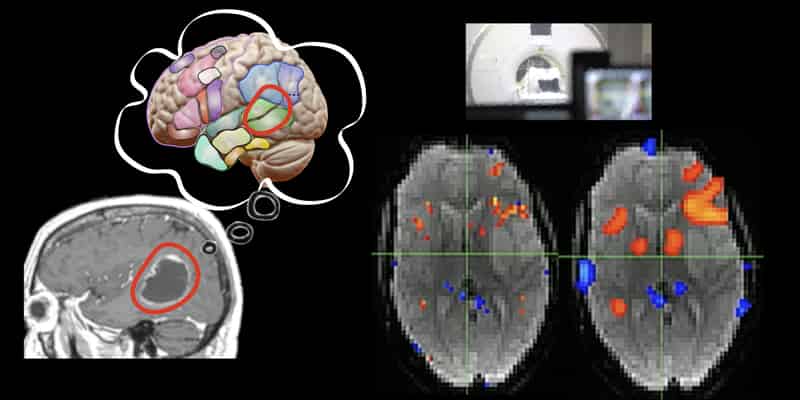 語学・辞書・学習参考書 fMRI: Functional Magnetic Resonance Imag