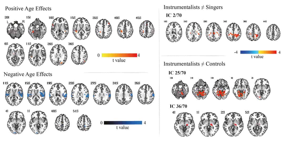 Aging of resting-state functional connectivity in amateur singers ...