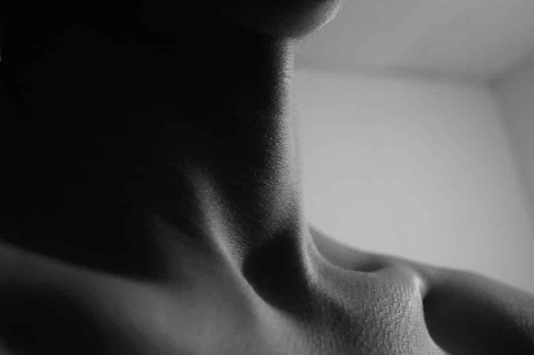 The vasospastic thyroid bilateral leg pain as a vascular manifestation