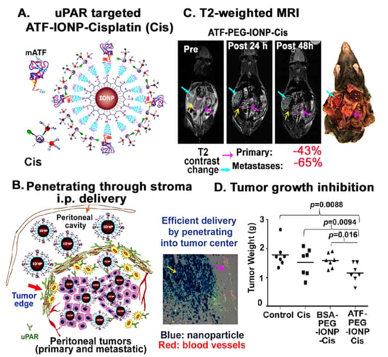Advances and Challenges in Tumor- and Stroma-Targeted Theranostic ...